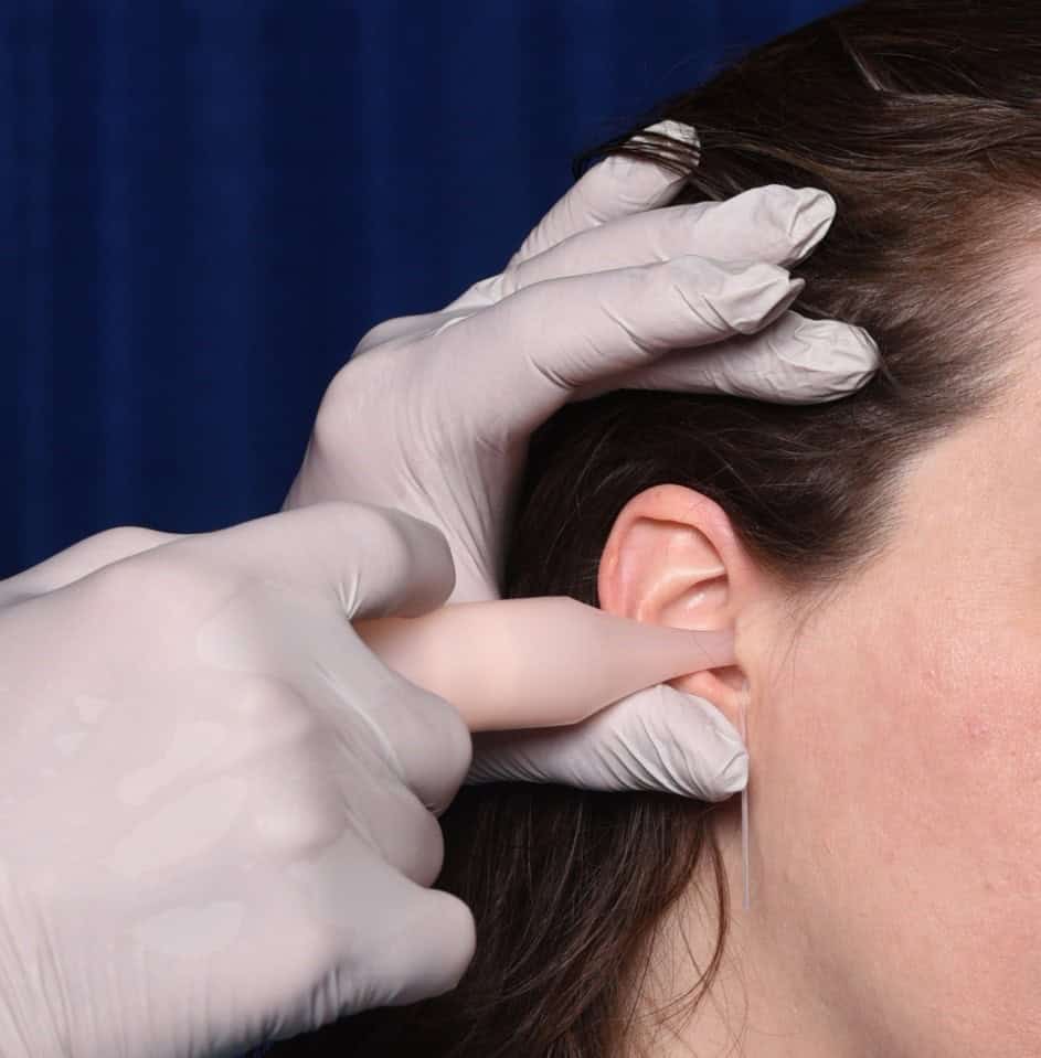 Ear examination for bridge-and-brace technique in clinical practice.